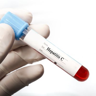 Ingyenes hepatitis C-szűrés lesz az ország több városában