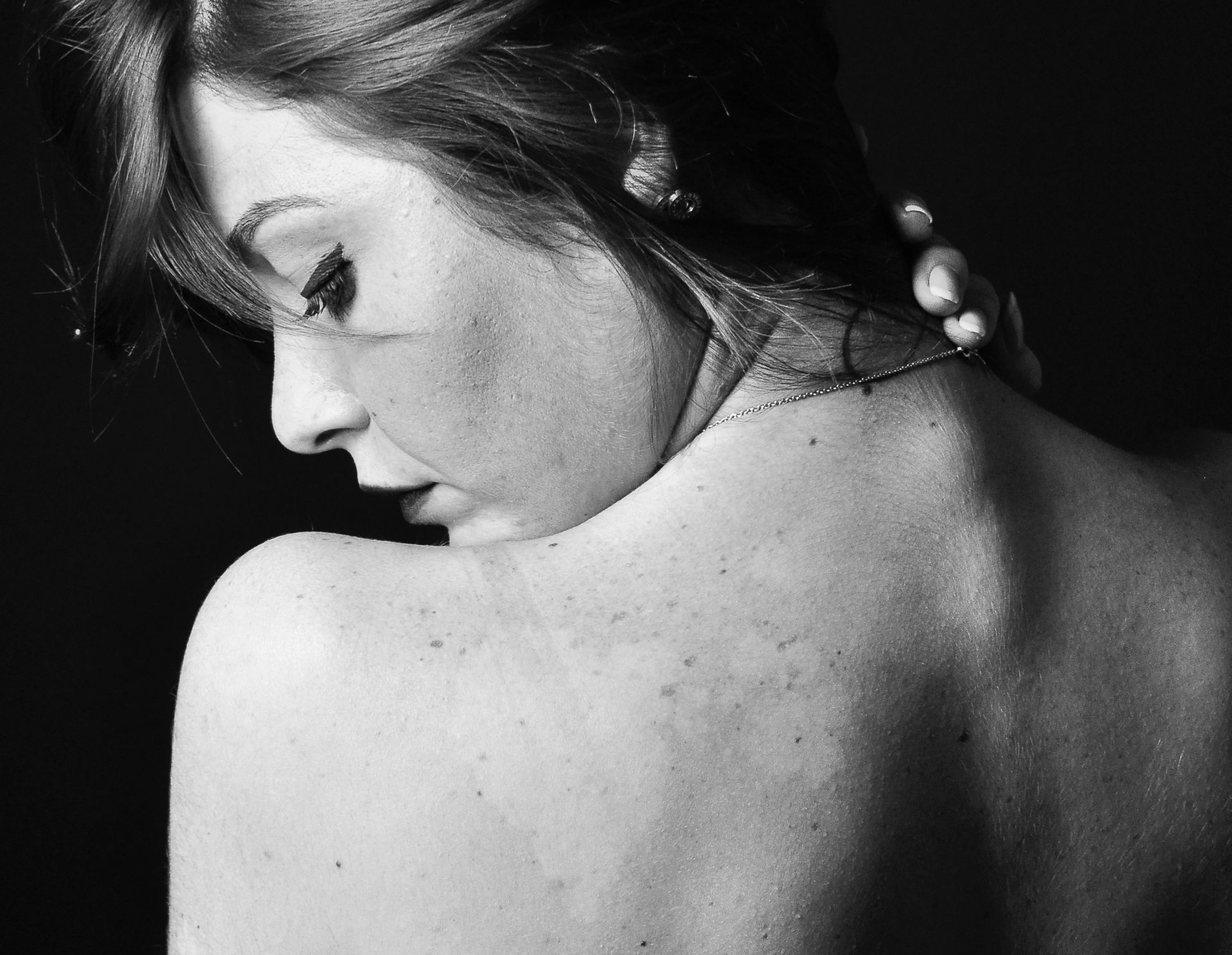 Miért nem elég csak egy anyajegyet megmutatni a bőgyógyásznak?